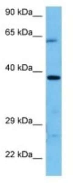VSIG2 Rabbit anti-Mouse, Polyclonal, Novus Biologicals 100 &mu;g; Unconjugated:Antibodies,